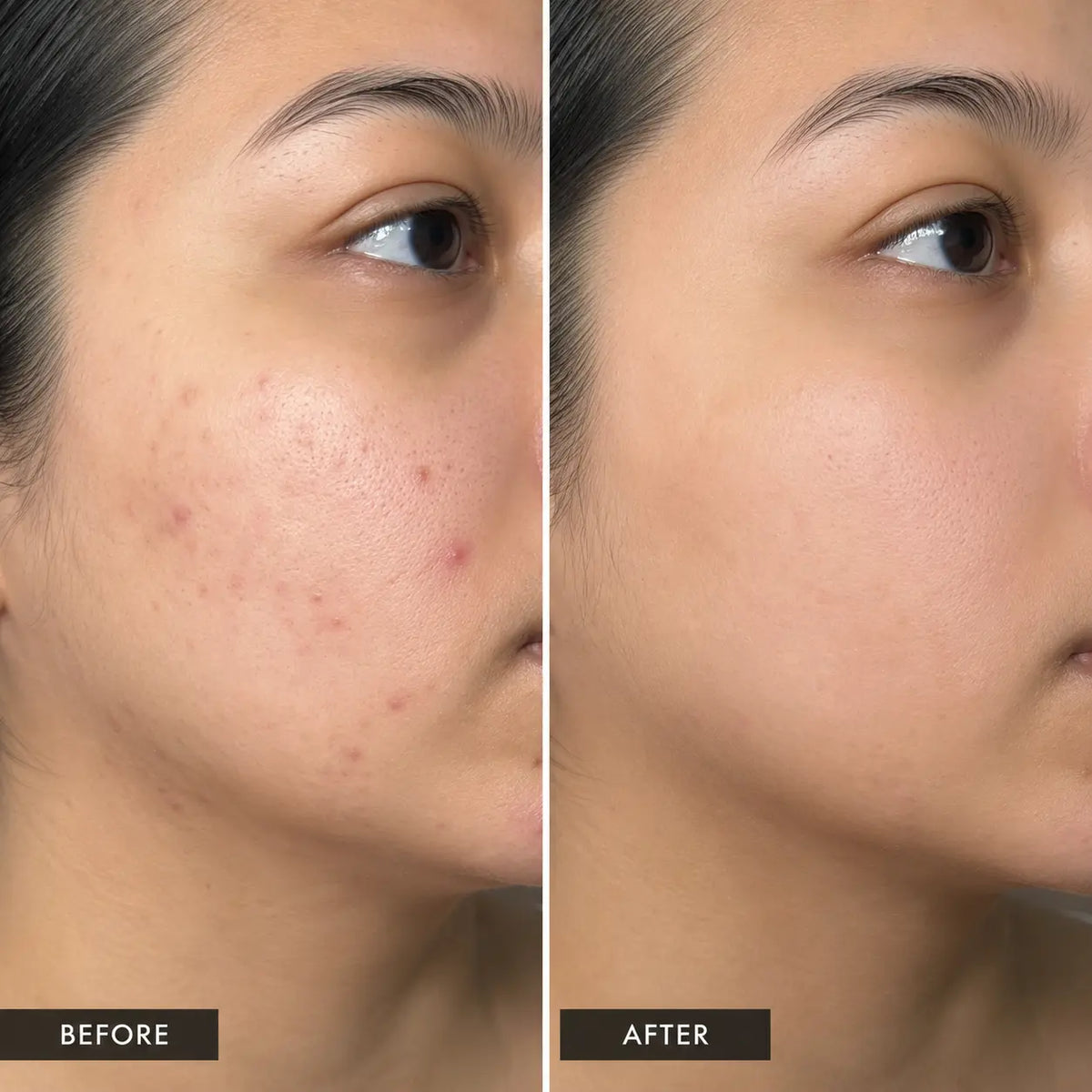 RetiChem Serum