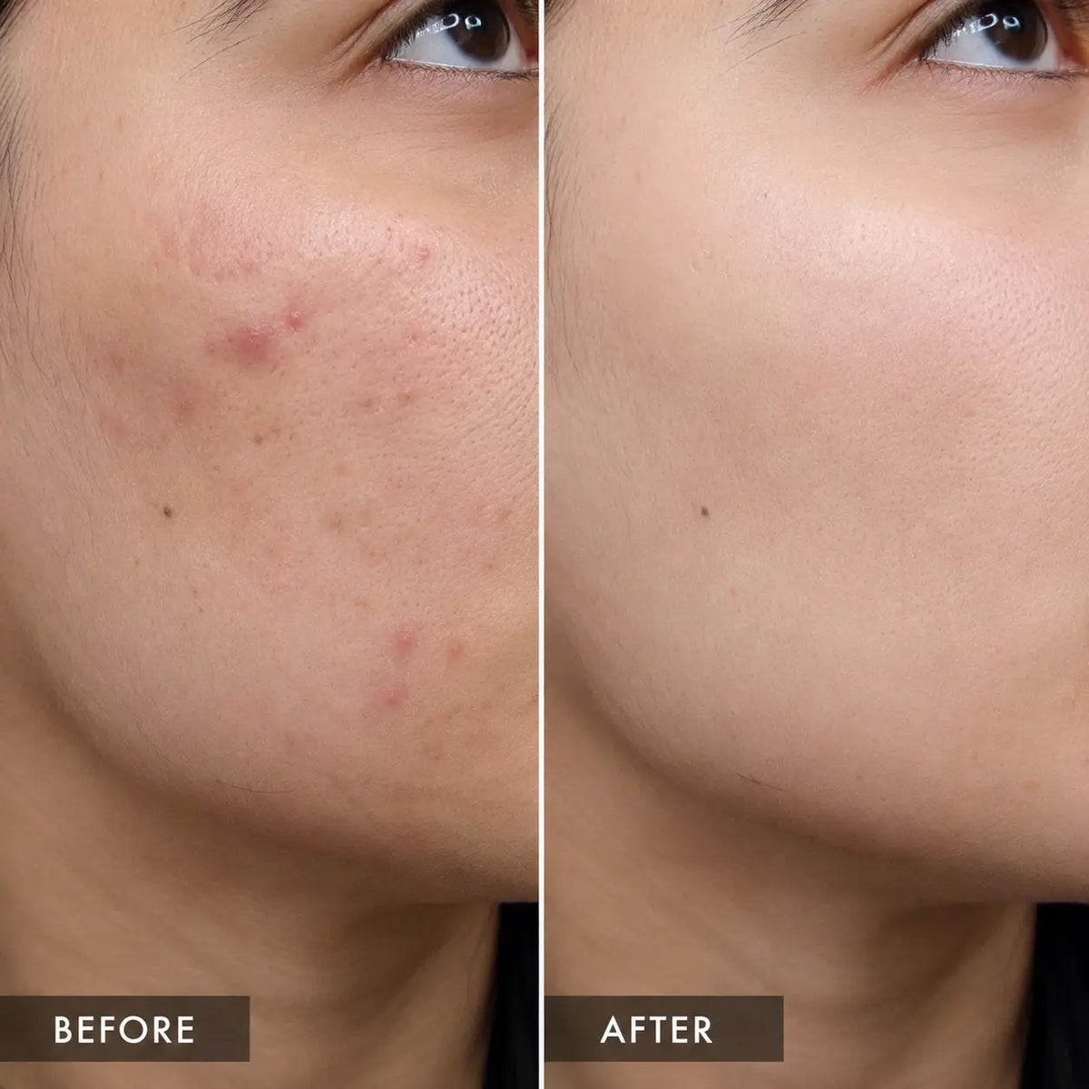 NiaChem Serum