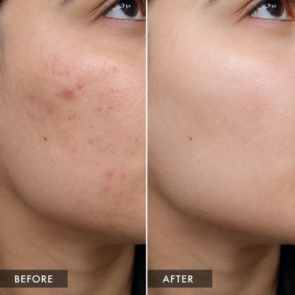 NiaChem Serum